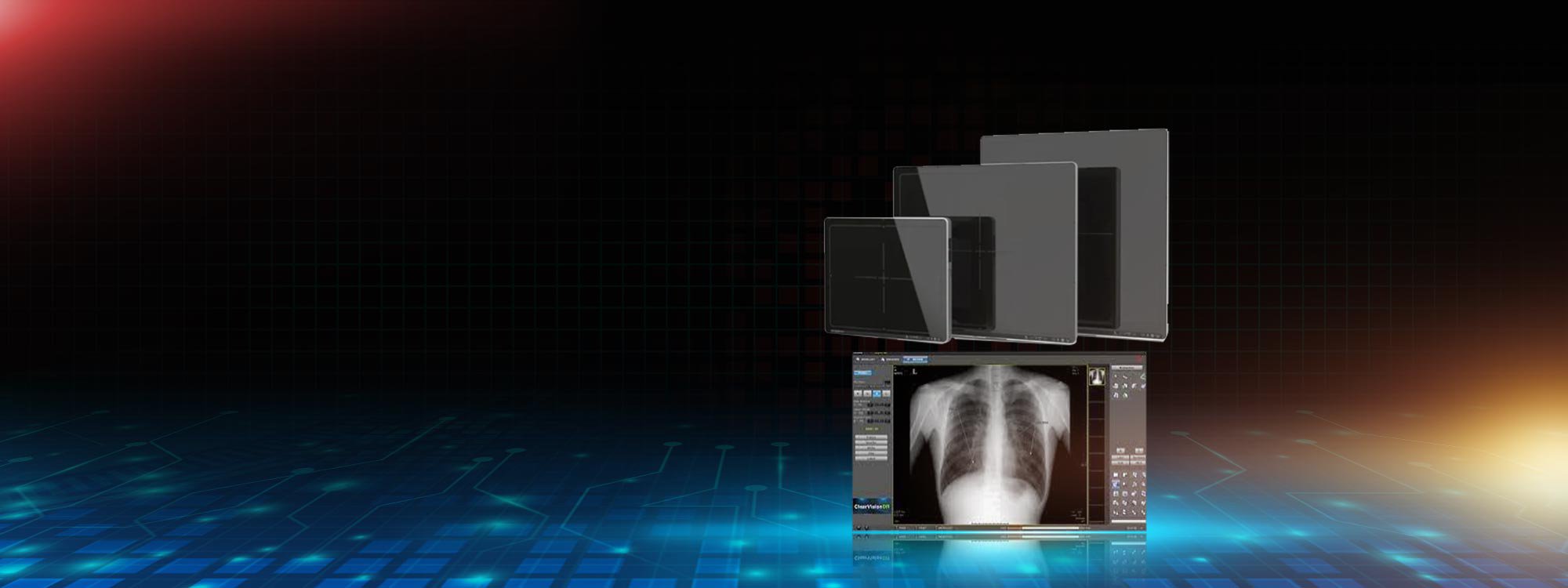 Digital X-Ray Equipment Technical Service